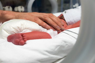 Premature baby being cared for in incubator