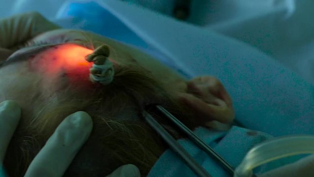 Doctor with an endoscope picks up the patient's skin during a facelift