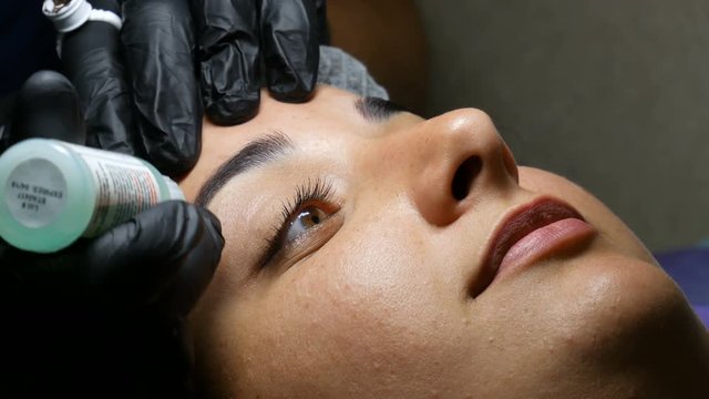 Application of the anesthesia under pellicle