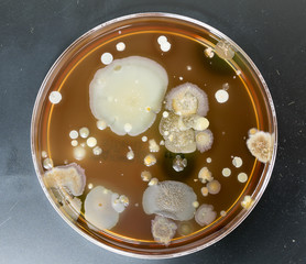 A petri dish with colonies of microorganisms for bacteriological analysis in a microbiological laboratory