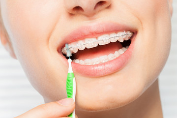 Woman using brush for orthodontic braces