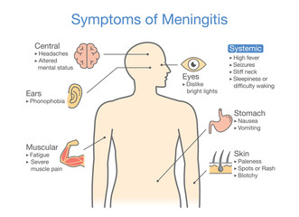 Symptoms of Meningitis patient. Diagram to showing signs of disease.