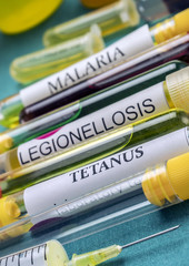 Some vials with samples of contagious diseases in a clinical laboratory