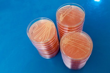Petri dishes with biological samples  for medical and biological analyzes