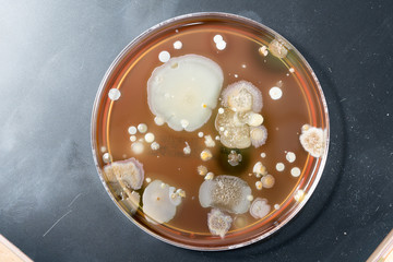 A petri dish with colonies of microorganisms for bacteriological analysis in a microbiological...
