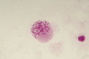 Female chromosomes inside the cell, light photomicrograph