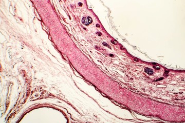Elastic cartilage of human outer ear, light micrograph