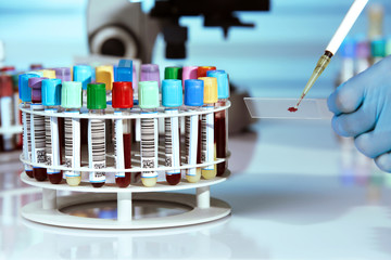 hand of doctor pipetting blood test in slide and rack of blood samples in the laboratory / Technician holding slide with blood sample test and a tray with blood tubes of patients in the lab