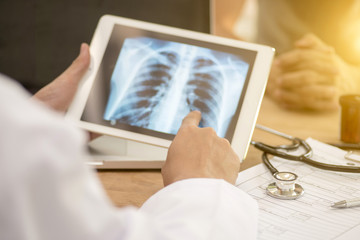 doctor looking at x-ray of lungs and writing diagnosis