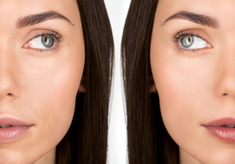 woman before and after retouch