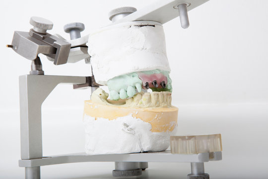 Testing of set of teeth in laboratory