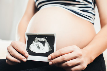 pregnant woman an ultrasound scan on her tummy