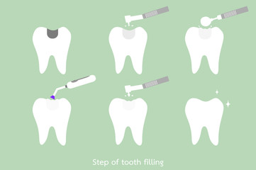 step of caries to tooth amalgam filling with dental tools