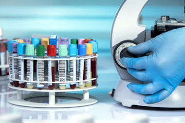 doctor examining in the microscope sample of blood test in the laboratory /hand of technician...