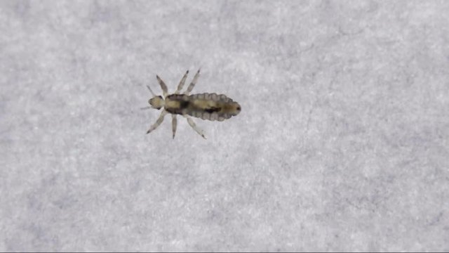 Closeup detail of head louse. Ectoparasite sucking human blood from front view. Head lice.