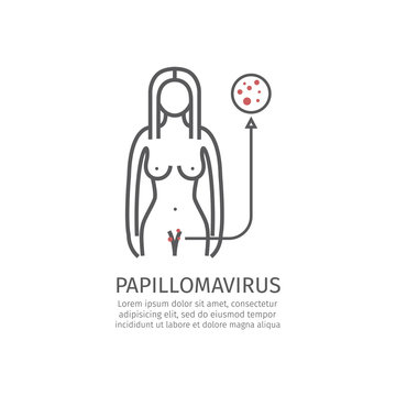 Human papillomavirus HPV. Vector illustration.