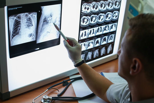 Carrying out a description of the radiographs of a patient with COPD