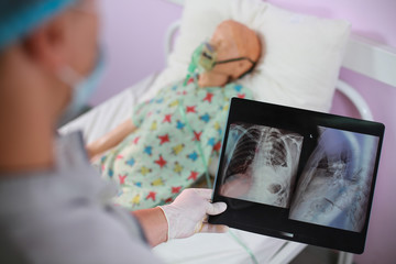 The doctor conducts a diagnostic search for lung diseases in a seriously ill middle-aged patient using the methods of physical examination and X-ray log