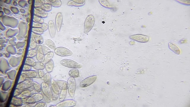 Microscope image footage of protozoa microorganisms in water, showing ciliates, paramecium, bacteria spirochaete and algae.