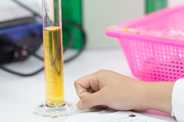Experiment chemical of urine in the laboratory.	