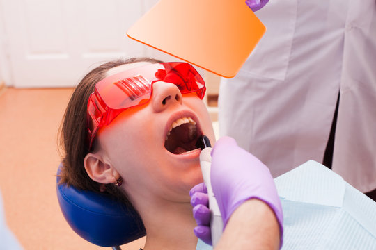 The dental polymerisation