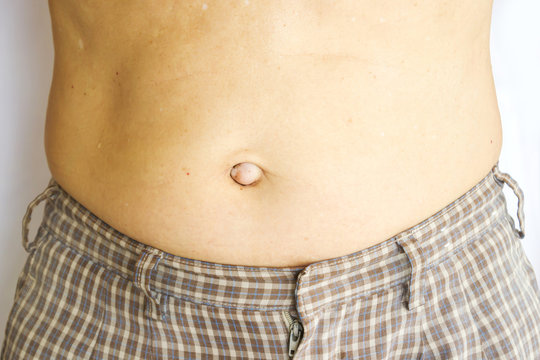 Closeup bulge navel of Asian old man. Portrait of body part on white background.
