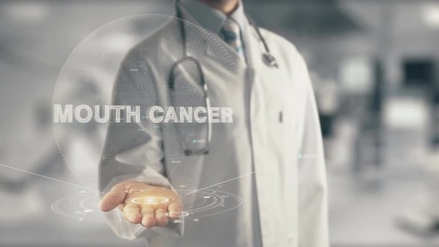 Doctor holding in hand Mouth Cancer