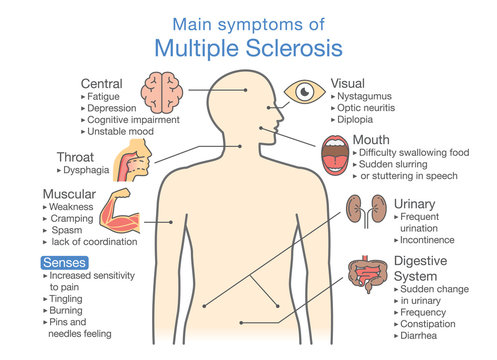Main symptoms of Multiple Sclerosis. Illustration about medical diagram of health check up.