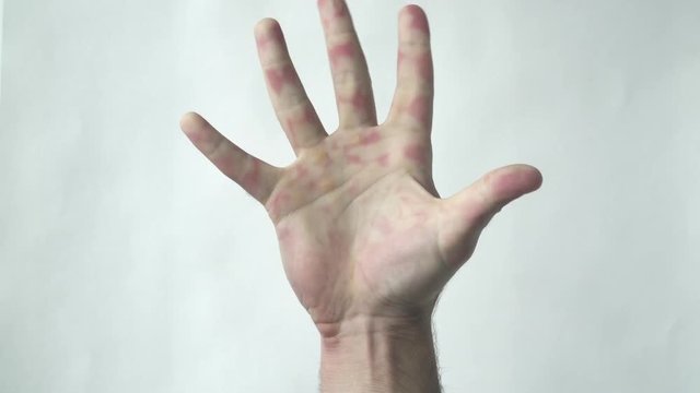 The man's hand holds, and then throws out the syringe. Victory over a disease or drug addiction.