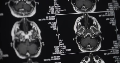 MRI Head Scans Close Up Pan Right. view pans right on a close up of a mri multiple head scans with one moving through the layers of the head - Powered by Adobe