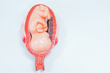 A fetus is a stage in the prenatal development