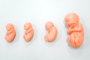 A fetus is a stage in the prenatal development