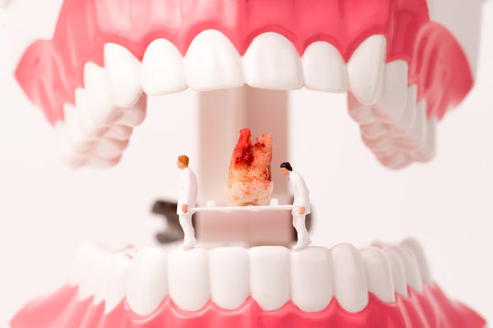 miniature people and dental model,dental care concept