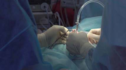 Operation using laparoscopic equipment. Surgeons team. Hospital.