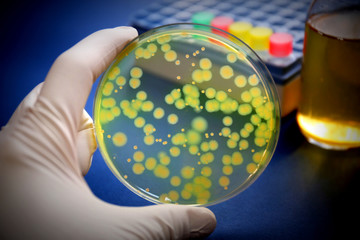 細菌の鑑別　緑膿菌　Pseudomonas aeruginosa