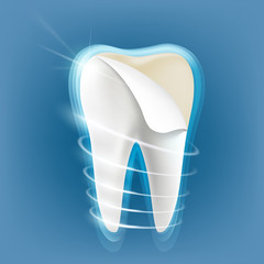 Dental porcelain veneers