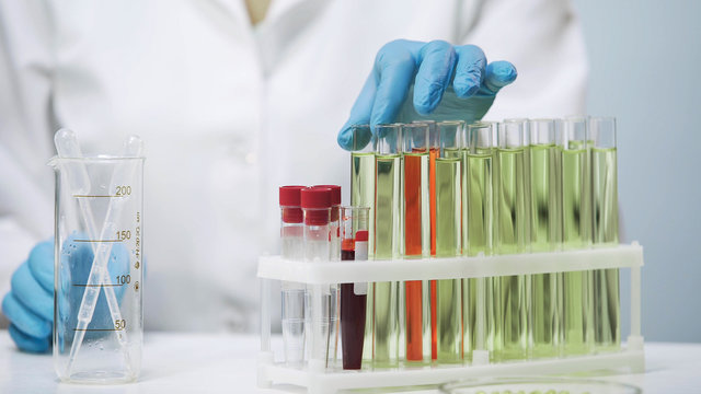 Doctor's hands taking test tube, female doing biomedical research in laboratory - Powered by Adobe