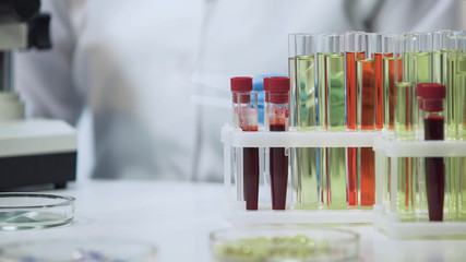 Clinical test, blood and vaccine samples standing on the table at laboratory