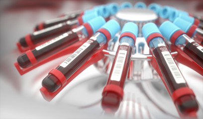 Blood Centrifuge Machine. Lab equipment centrifuging blood. Concept image of a blood test. - obrazy, fototapety, plakaty