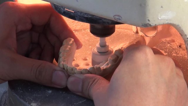 Close-up of the hands of a dentist who is filing the imperfections of a denture made with plaster. Dental impression in a laboratory.