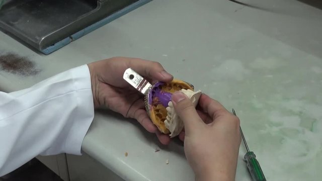 Close-up of the hands of a dentist who is removing a plaster denture from the mold. Dental impression in a laboratory.