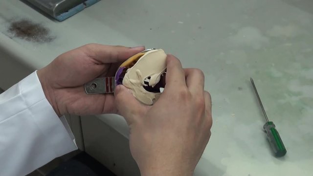 Close-up of the hands of a dentist who is removing a plaster denture from the mold. Dental impression in a laboratory.