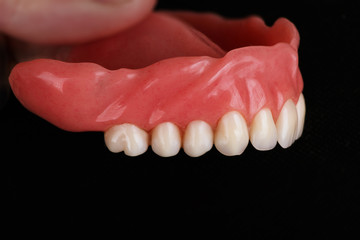 upper part of dental prosthesis, removed from lateral view on a black background