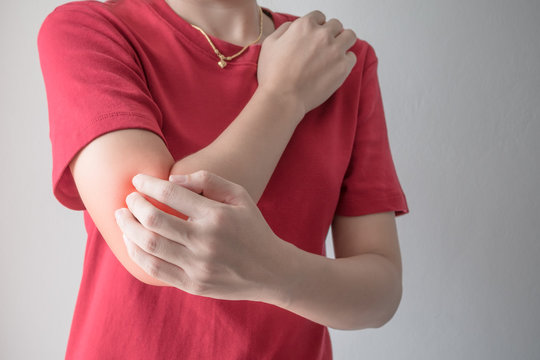 Woman Scratching Her Elbow.