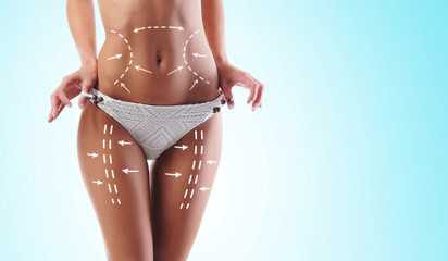 Women slim body in swimwear having arrows along her stomach and legs. Fat lose, liposuction and cellulite removal concept. - obrazy, fototapety, plakaty