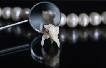  bad rotten tooth pulled and stands opposite the offices of the mirrors and dazzling white pearls...