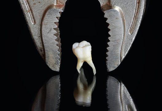 scary metal tongs over a bad rotten tooth pulled and stands on a black isolated background