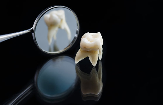 bad rotten tooth is pulled out and is located opposite the dental mirror on a black background