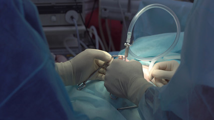 Operation using laparoscopic equipment. Surgeons team. Hospital.