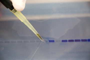 Agarose gel electrophoresis is a method of gel electrophoresis used in biochemistry, molecular...